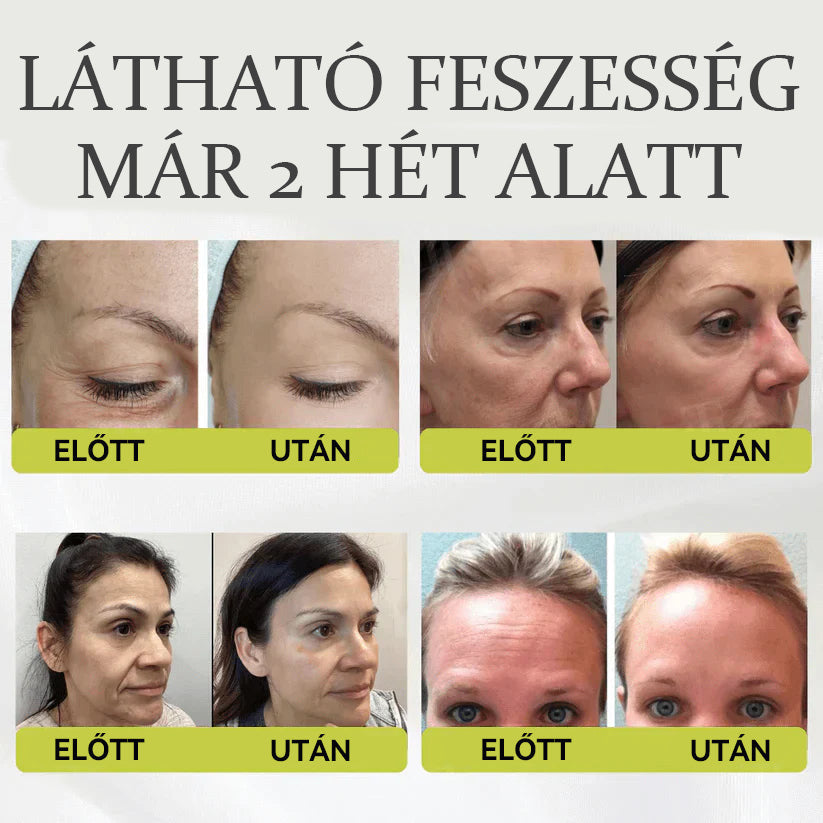 🔥Csak ma! A második termék -50% 🇭🇺𝗛𝗶𝘃𝗮𝘁𝗮𝗹𝗼𝘀 Á𝗿𝘂𝗵á𝘇 💯