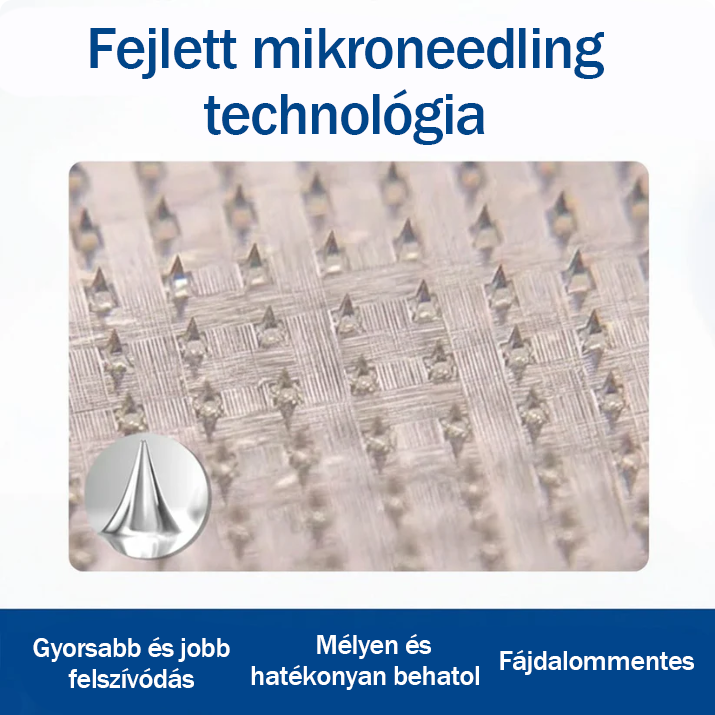 ☘️☘️🇭🇺👨‍⚕️✅TAILEDEN® VeinEase Mikrotűs Kezelő Tapasz⚡Azonnali Megkönnyebbülés, Hosszú Távú Eredmények