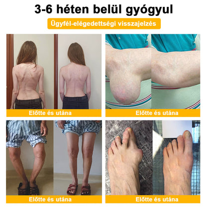 🔥ADNOON® Botulinum Toxin & Méhméreg Fájdalomcsillapító Csontgyógyító Krém👨‍⚕️