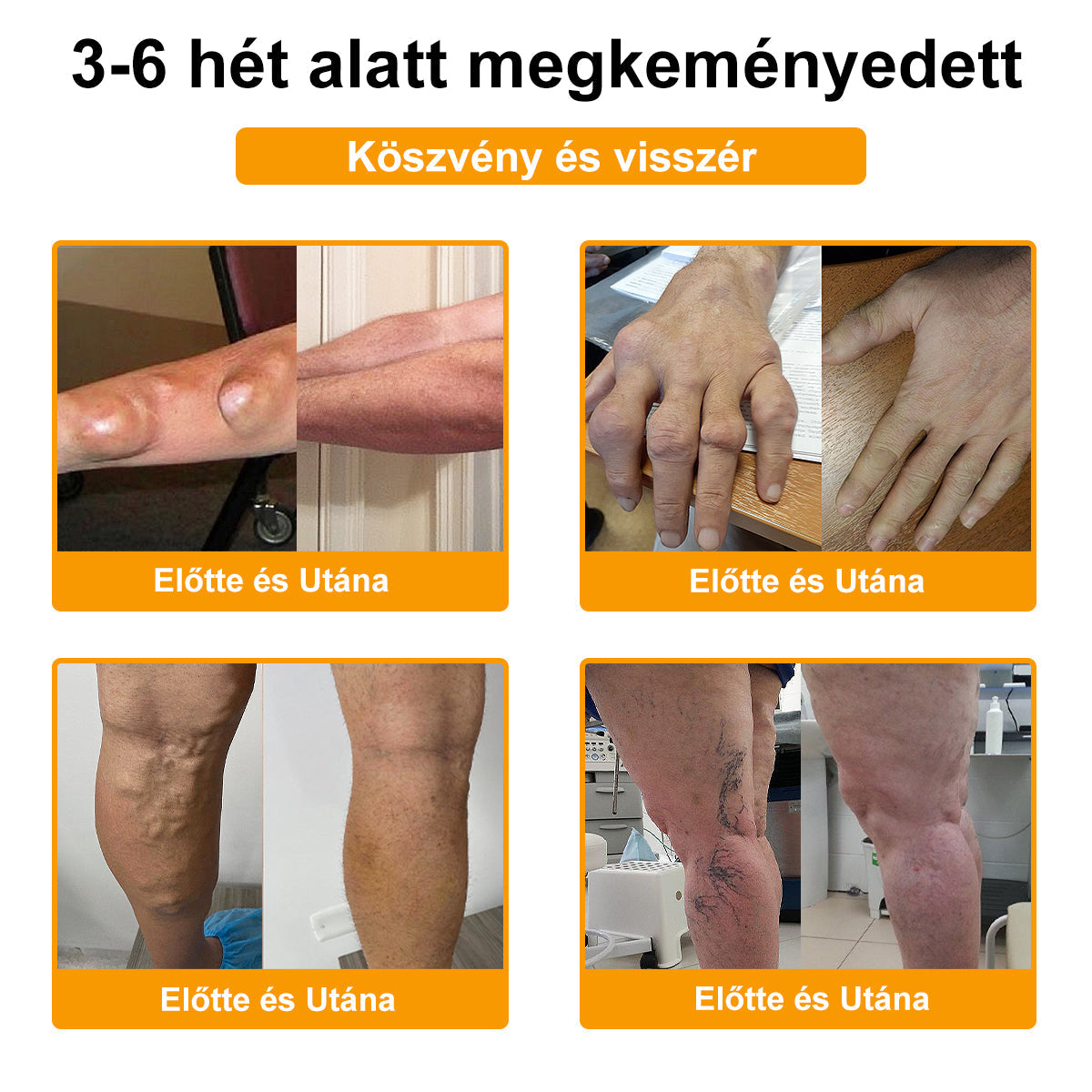 🔥ADNOON® Botulinum Toxin & Méhméreg Fájdalomcsillapító Csontgyógyító Krém👨‍⚕️