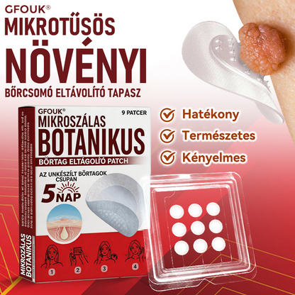 ✅ GFOUK® Mikrotűs növényi bőrkinövés eltávolító tapasz