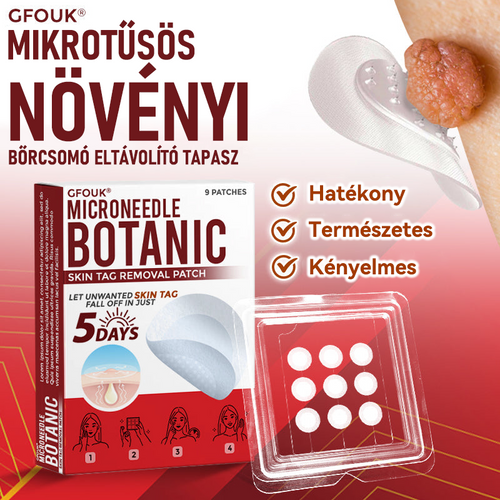 🎁 Már csak 5 csomag maradt! Most további 50% KEDVEZMÉNYT kaphatsz!  Segít láthatóan csökkenteni a bőrkinövéseket, szemölcsöket és egyéb bőrhibákat — gyorsan, kényelmesen és fájdalommentesen. 🌿