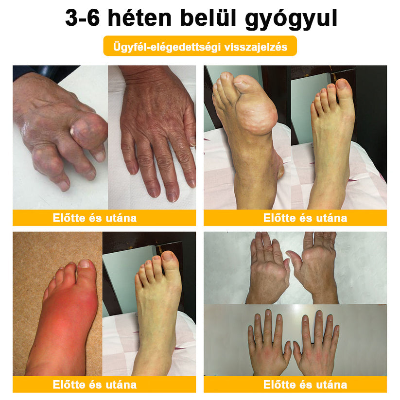 🔥ADNOON® Botulinum Toxin & Méhméreg Fájdalomcsillapító Csontgyógyító Krém👨‍⚕️