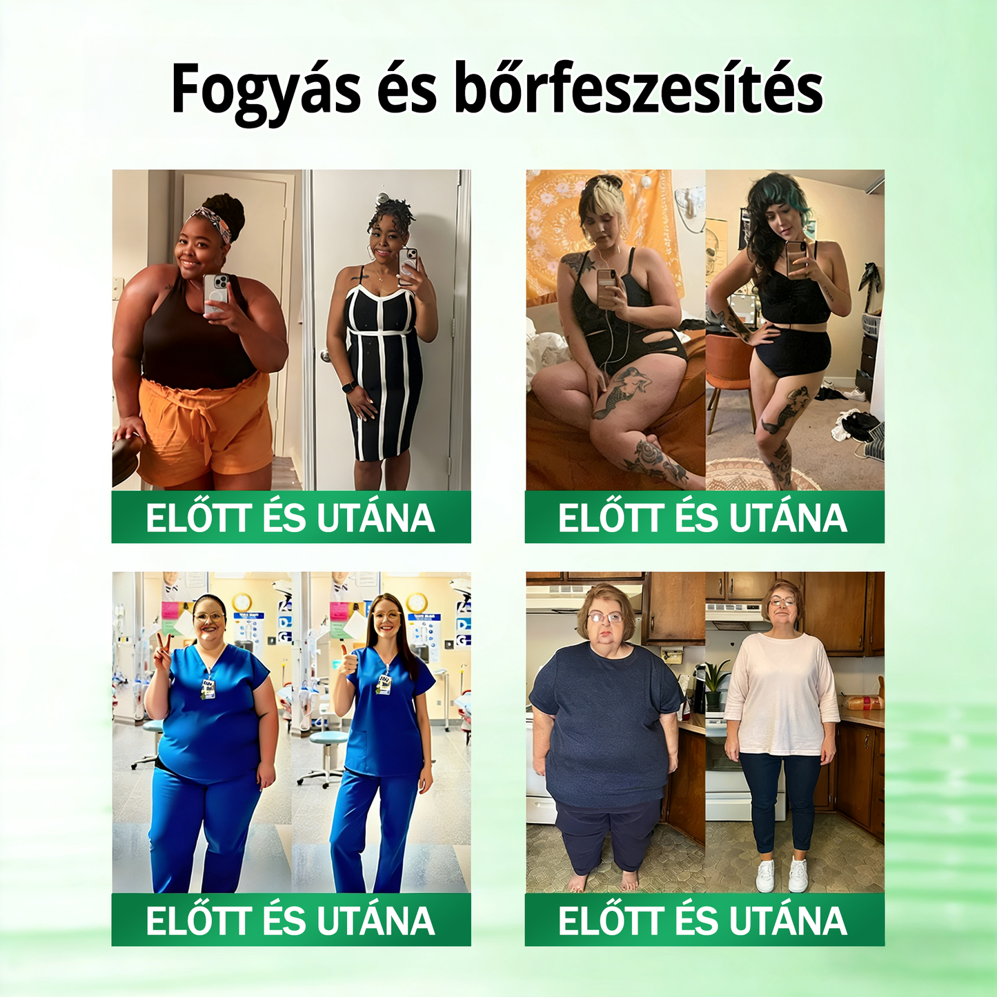 🧑‍⚕️KKIO® 20 az 1-ben Glumasetide Fit & Vital mikrotűs tapasz - 7 napon belül látható változás / Alkalmas elhízás, szív- és érrendszeri egészség, cukorbetegség, alvási apnoé, bélrendszeri egészség, ízületi problémák és számos egyéb állapot esetén.