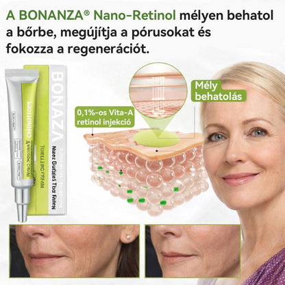 🎉 Büszkén az Európai Unióban gyártva 💫 Tiworld® fejlett peptid Botox-hatású + Vita-A retinol feszesítő megújító krém – ma csak 70% KEDVEZMÉNNYEL