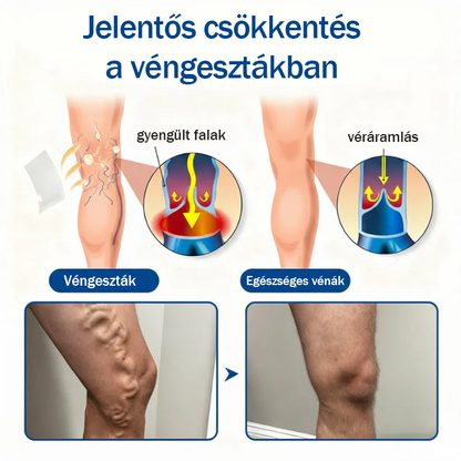 ☘️☘️🇭🇺👨‍⚕️✅TAILEDEN® VeinEase Mikrotűs Kezelő Tapasz⚡Azonnali Megkönnyebbülés, Hosszú Távú Eredmények
