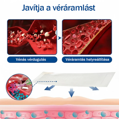 ☘️☘️🇭🇺👨‍⚕️✅TAILEDEN® VeinEase Mikrotűs Kezelő Tapasz⚡Azonnali Megkönnyebbülés, Hosszú Távú Eredmények