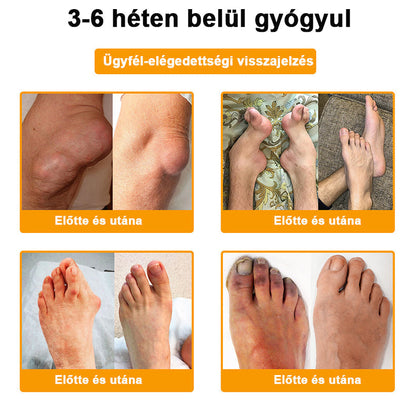 🔥ADNOON® Botulinum Toxin & Méhméreg Fájdalomcsillapító Csontgyógyító Krém👨‍⚕️
