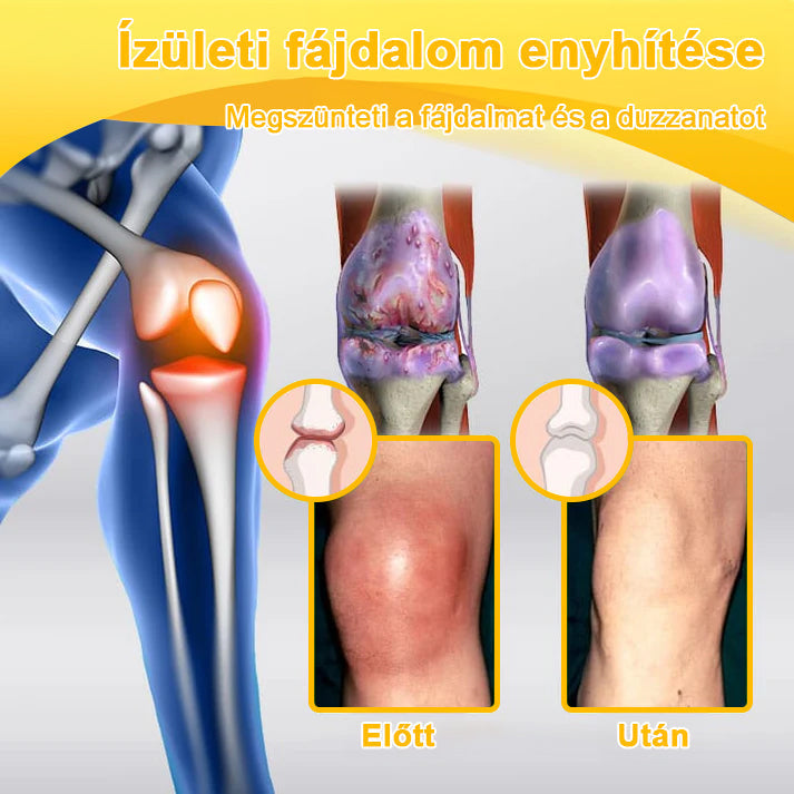 🔥ADNOON® Botulinum Toxin & Méhméreg Fájdalomcsillapító Csontgyógyító Krém👨‍⚕️