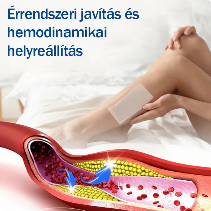 ☘️☘️🇭🇺👨‍⚕️✅TAILEDEN® VeinEase Mikrotűs Kezelő Tapasz⚡Azonnali Megkönnyebbülés, Hosszú Távú Eredmények