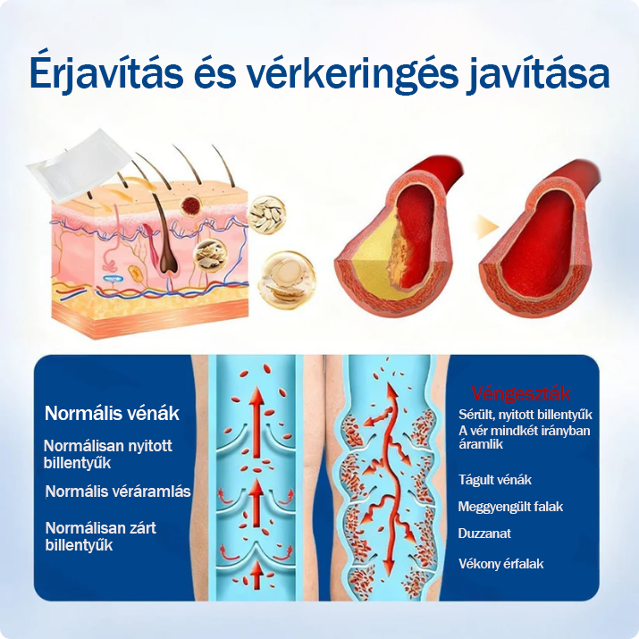 ☘️☘️🇭🇺👨‍⚕️✅TAILEDEN® VeinEase Mikrotűs Kezelő Tapasz⚡Azonnali Megkönnyebbülés, Hosszú Távú Eredmények